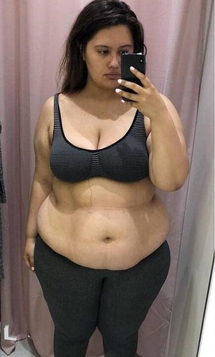 Sovražila sem svoje telo zaradi odvečnih kilogramov.